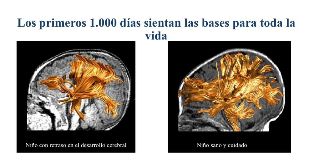 Lámina sobre el impacto de la DCI